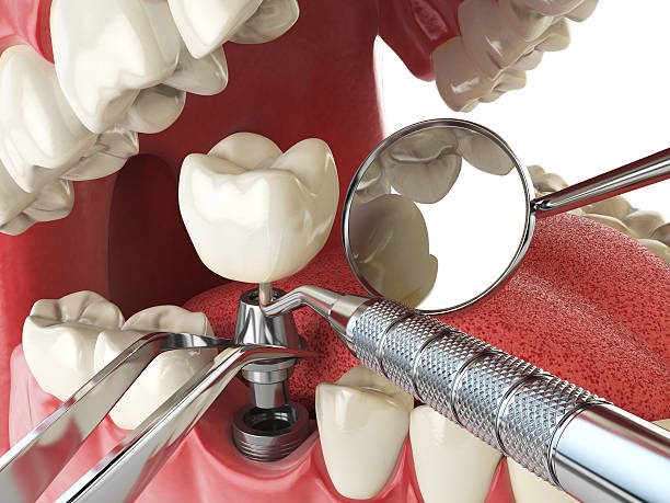 Best Same-Day Emergency Dentist in Woodburn, VA
