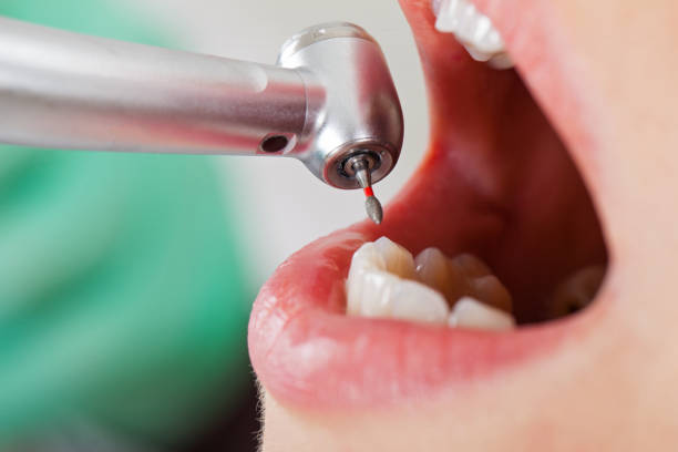 Best Emergency Treatment for Toothache in Woodburn, VA